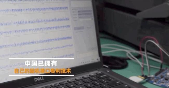 中国「意念购」技术挑战马斯克脑机接口！网友：剁手升级砍头了