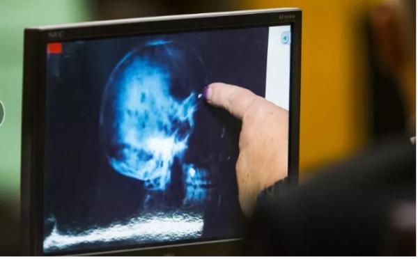 中国「意念购」技术挑战马斯克脑机接口！网友：剁手升级砍头了