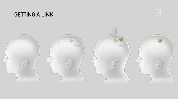 以AI反制AI ？马斯克脑机接口实现与猪连接