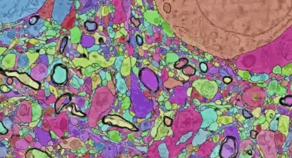 谷歌发布史上超强人类大脑「地图」，在线可视3D神经元「森林」